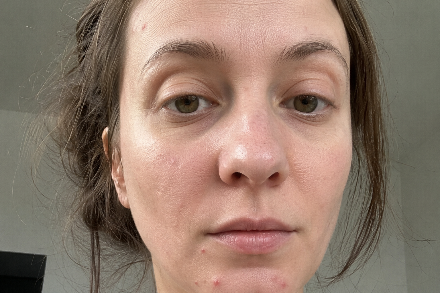 Before — 8-week study